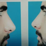 دکتر مژگان کیانی آسیابر متخصص گوش و حلق و بینی در تهران