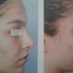 دکتر مژگان کیانی آسیابر متخصص گوش و حلق و بینی در تهران