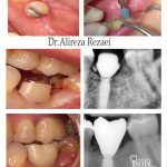 جراح دندانپزشک علیرضا رضایی