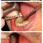 جراح دندانپزشک علیرضا رضایی