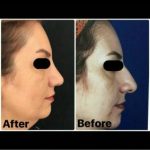 دکتر سلیمان حسینی خلیفانی در ارومیه