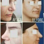 دکتر سلیمان حسینی خلیفانی در ارومیه