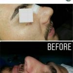 دکتر سلیمان حسینی خلیفانی در ارومیه