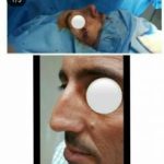 دکتر سلیمان حسینی خلیفانی در ارومیه