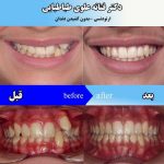 دکتر فتانه علوی طباطبایی در تهران