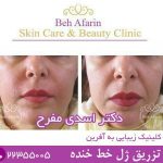 دکتر مهدی اسدی مفرح متخصص پوست و مو و زیبایی در تهران