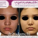 دکتر بهرام بادامچی در تهران