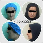 دکتر آیت پوزش در شیراز