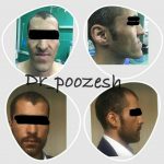 دکتر آیت پوزش در شیراز