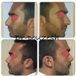 دکتر آیت پوزش در شیراز