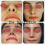 دکتر آیت پوزش در شیراز