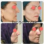 دکتر آیت پوزش در شیراز