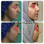 دکتر آیت پوزش در شیراز