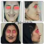 دکتر آیت پوزش در شیراز