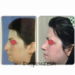 دکتر آیت پوزش در شیراز