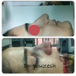 دکتر آیت پوزش در شیراز