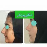 دکتر آیت پوزش در شیراز