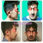 دکتر آیت پوزش در شیراز