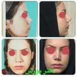 دکتر آیت پوزش در شیراز