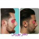 دکتر آیت پوزش در شیراز