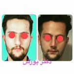 دکتر آیت پوزش در شیراز