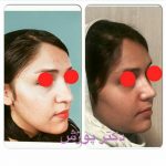 دکتر آیت پوزش در شیراز