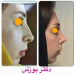 دکتر آیت پوزش در شیراز