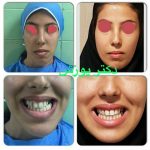 دکتر آیت پوزش در شیراز