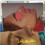 دکتر آیت پوزش در شیراز