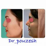 دکتر آیت پوزش در شیراز