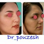 دکتر آیت پوزش در شیراز