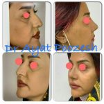 دکتر آیت پوزش در شیراز