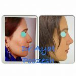 دکتر آیت پوزش در شیراز