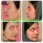 دکتر آیت پوزش در شیراز