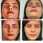 دکتر آیت پوزش در شیراز