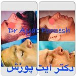 دکتر آیت پوزش در شیراز