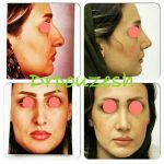 دکتر آیت پوزش در شیراز