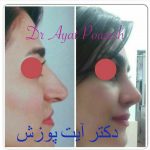 دکتر آیت پوزش در شیراز