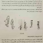 کلینیک پروتز چشم بیناسا در تهران