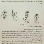 کلینیک پروتز چشم بیناسا در تهران