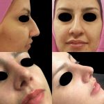 دکتر لیلا شریفی در شیراز