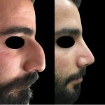 دکتر لیلا شریفی در شیراز