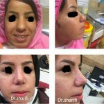 دکتر لیلا شریفی در شیراز