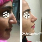 دکتر لیلا شریفی در شیراز