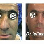 دکتر لیلا شریفی در شیراز