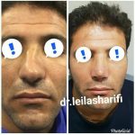 دکتر لیلا شریفی در شیراز