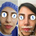 دکتر لیلا شریفی در شیراز