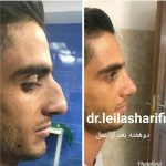 دکتر لیلا شریفی در شیراز