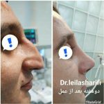 دکتر لیلا شریفی در شیراز