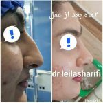 دکتر لیلا شریفی در شیراز